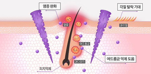 스피큘 효과 체크 & 리르 스피큘 스팟 세럼 후기 (모공 잡티 케어)